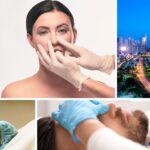 rhinoplasty